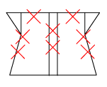 頸椎部のチェック図