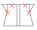 頸椎部のチェック図